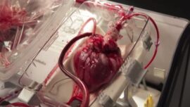 corazones muertos revividos para trasplante con nueva tecnologia medica 2